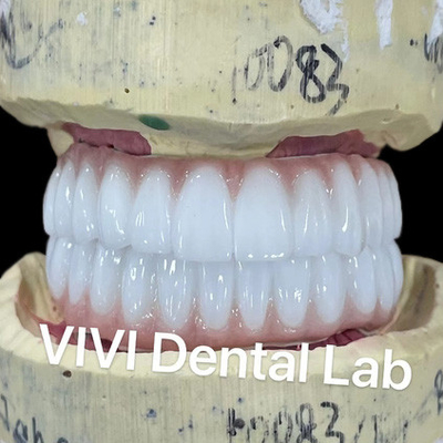 Ni Be Free Zirconia Dental Implant Bridge On Bar उच्च सौंदर्यशास्त्र