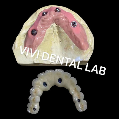 चार पर सभी स्क्रूड Zirconia ब्रिज Ivoclar दंत चिकित्सा उच्च सटीकता