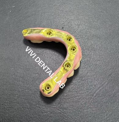 टाइटेनियम बार समर्थन के साथ पूर्ण Zirconia पुल चीन दंत प्रयोगशाला