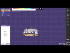 अंगूठे का दांत