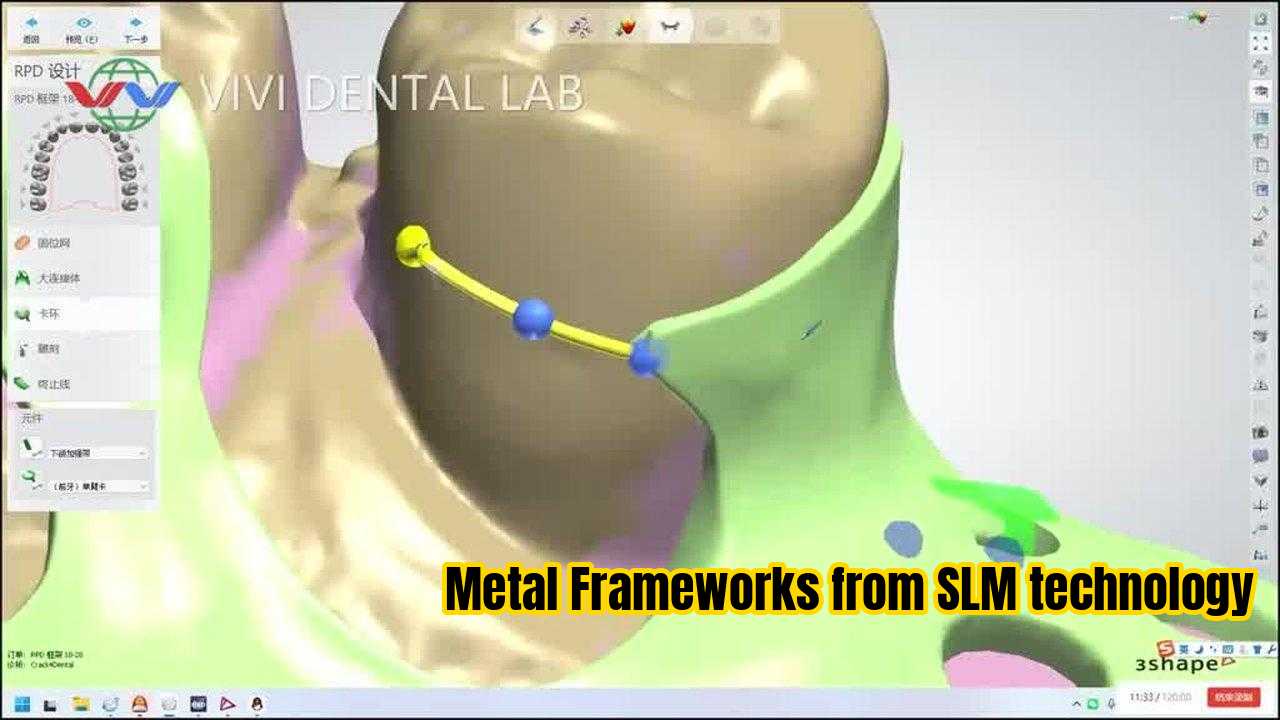 चीन VIVI DENTAI LABORATORY प्रमाणपत्र